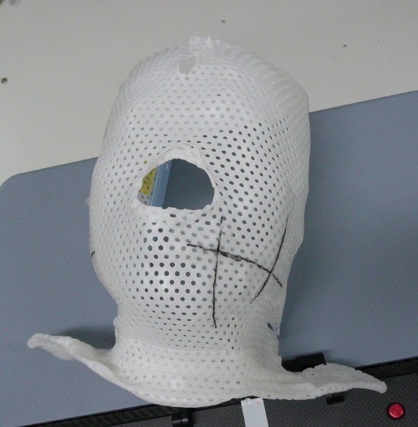放射線治療用マスク